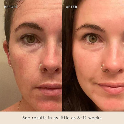 Barefaced Core Four (Retinoid Alternative) - Toning Pads II, Liquid Gold, Overachiever, Tinted SPF