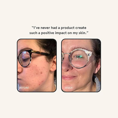 Barefaced Overachiever 1 Fl Oz – 10-in-1 Skin Booster with Bakuchiol, Resveratrol & Green Tea – Retinol Alternative, Pregnancy-Safe, Hydrates, Minimizes Pores & Fine Lines