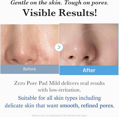 Medicube Zero Pore Pads Mild 2.0 (70 units) - Gentle Calming Toner Pads for Exfoliation, Minimizing Pores, and Blackhead Removal with PHA - Ideal for All Skin Types - Korean Skin Care