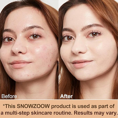 4 in 1 foundation Liquid- Hydrating Medium full coverage concealer -SPF 50+ -Longwearing & Waterproof-korean makeup (Medium Spectrum -Gold Lid- for people with fair skin)