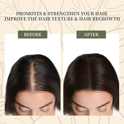 Batana Oil for Hair Growth,100% Pure & Natural Raw Batana Oil, Dr. Sebi Organic from Honduras,Care for Hair Thickness,Scalp&Skin,4.23 fl oz,1 Bottle with 2 Caps