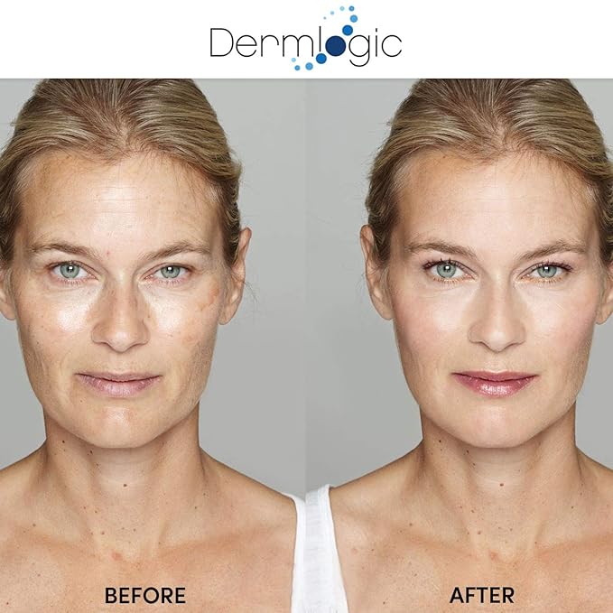 Anti Aging Resurfacing Peel Pads - Contains Salicylic, Glycolic, & Lactic for Face, Neck & Décolleté. Exfoliates, Brightens, Tones the Skin & Reduces Dark Spot, Fine Lines & Wrinkles for Radiant Glow.