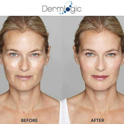 Anti Aging Resurfacing Peel Pads - Contains Salicylic, Glycolic, & Lactic for Face, Neck & Décolleté. Exfoliates, Brightens, Tones the Skin & Reduces Dark Spot, Fine Lines & Wrinkles for Radiant Glow.