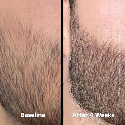 DABALASH Men Professional Facial Hair, Eyelash & Brow Growth Serum with Castor Oil – Promotes the Appearance of Naturally Longer, Fuller, Thicker & Stronger Hair – 0.18 oz