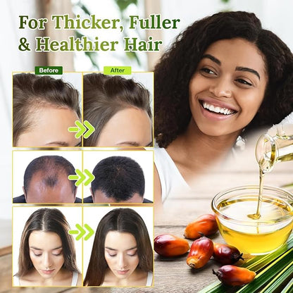 100% Raw Batana Oil for Hair Growth, Natural Raw and Pure Unrefined Batana Oil Organic Hair Oil Prevent Hair Loss, Restores Damaged Hair and Scalp, 4.2 OZ (1 PCS)