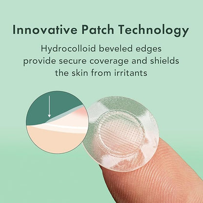 Rael Pimple Patches, Miracle Microcrystal Spot Cover - Hydrocolloid Acne Pimple Patch with Tea Tree Oil, Early Stage Zits and Blemish, Korean Skin Care (18 Count)