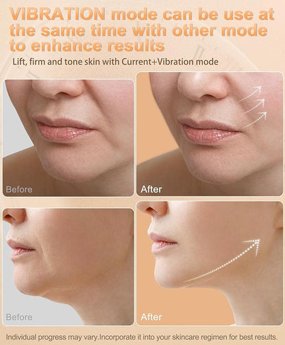 Radio Frequency Skin Tightening Device | 6 in 1 Home RF Face Beauty Device | Professional Facial Skin Tightening | Lifting | Wrinkle Reducing | Anti Aging | Depuff | Increase Absorption(with Gel)