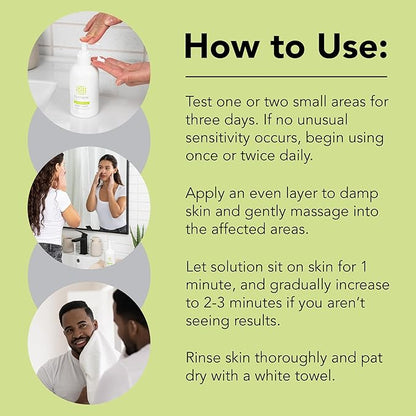 humane Benzoyl Peroxide Acne Body Wash - 10% Maximum-Strength Face, Skin, Butt, and Back Acne Treatment - 16 Fl Oz - Dermatologist-Tested Non-Foaming Acne Face Wash Cleanser - Vegan, Cruelty-Free
