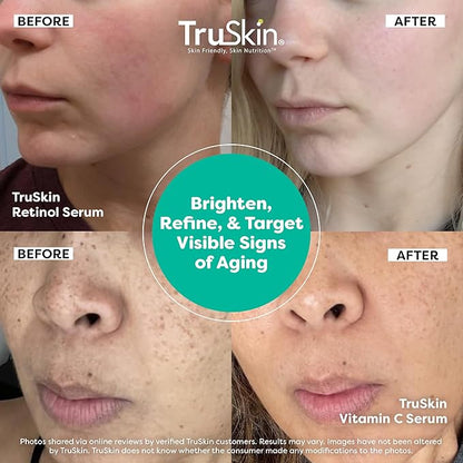 TruSkin Face Serum Duo – Vitamin C & Retinol Serum for Face – Anti-Aging Skin Care Gift Set for Women – Helps Improve Appearance of Fine Lines & Wrinkles for Smoother Looking Skin, 1 Fl Oz, 2 Bottles