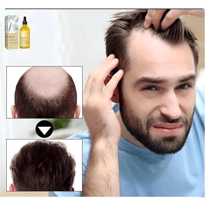 LOVILDS Rosemary Hair Growth Essence, Lovilds Rosemary Hair Growth Oil - 2 Ounce, Rosemary Rosemary Hair & Hair Strengthening Oil for All Hair Types (2 Bottles)