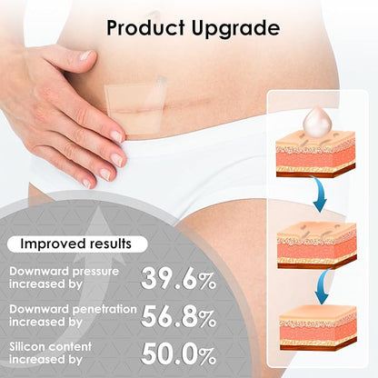 Silicone Scar Sheets,Silicone Scar Tape for Removal Treatment,Medical Grade Scar Tape for Surgical Scars,C-Section,Tummy Tuck,Scar Removal Away(1.6" x 60" Roll - 1.5M) Keloid Bump Removal