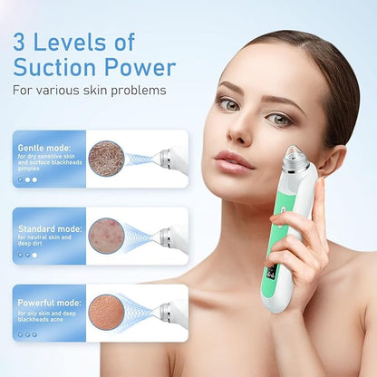 Facial Pore Blackhead Remover Vacuum, 1080P Camera Blackhead Remover, 20x Zoom, 8 LEDs ＆ 3 Suction Modes, 800mAh Battery & USB - 6 Heads Pore Cleaner Kit for Women&Men(Green)
