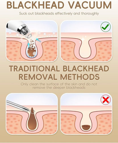 Facial Pore Blackhead Remover Vacuum - Fore Cleaner and Blackhead Extractor with 3 Adjustable Suction Levels - 5 Probes - Pore Vacuum Kit for Women&Men (White)