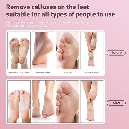 Electric Foot Callus Remover,2 in1 Rechargeable Callus Remover for Feet,9-Speed Cordless Electric Foot File Nail Grinder,Foot Scrubber Pedicure Tools for Dead Skin Dry Cracked Feet(Pink Fold)