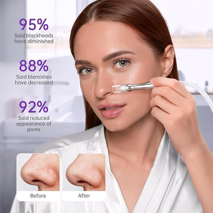 UNOISETION Blackhead Vacuum Removers, 2 in 1 Pro-Grade at-Home Spa Facial Vacuum Pore Cleaner for Blackheads, Whiteheads, Exfoliation, 20-80 Kpa Adjustable Suction for All Skin Types, White