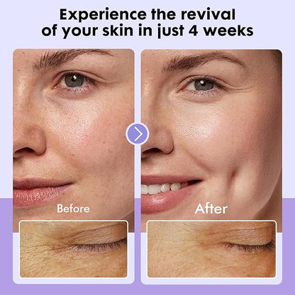 Dermasof Multi Peptide Power Serum for Face with Copper Peptides, Anti Aging, Firming and Lifting, Reduce Fine Lines and Wrinkles, Boost Collagen, Hydration, Barrier Repair, For All Skin Types 30mL