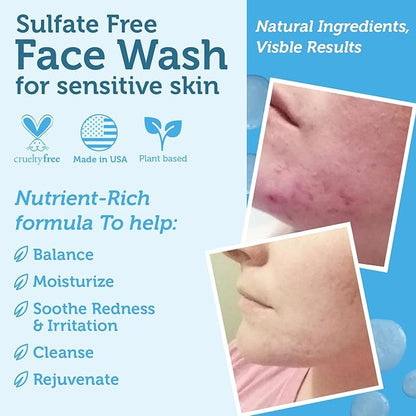 Era Organics Manuka Honey Face Wash for Sensitive Skin - Sulfate Free Gentle Cleanser with Organic Aloe Vera, Hyaluronic Acid & More - Soothing & Moisturizing for Dry Skin - Made in USA (8 oz)