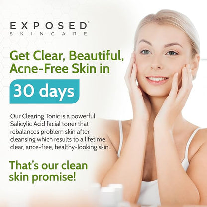 Exposed Skin Care, Clearing Tonic Facial Toner with 1% Salicylic Acid and Witch Hazel – Daily Toner for Teen and Adult Acne, Blackheads and Oily Skin – Natural, Non-Toxic and Cruelty Free