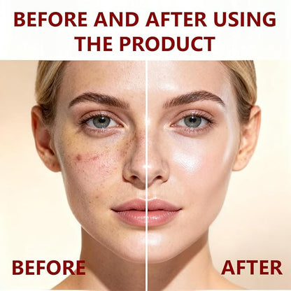 Peel Shot Glow Rice Peeling Ampoule Duo, White Rice Refines Texture+Hyaluronic Acid Locks Moisture, Black Rice Niacinamide Controls Oil Salicylic Acid Gentle Pore Clean, For Various Skins (5.4 fl oz)
