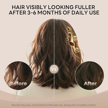 ALFHEIM Coffee+ Thickening Leave-in Spray for Fine & Thinning Hair with Caffeine, Biotin & Arabica Coffee Oil – Strengthening, Volumizing & Heat-Protecting Formula – Sulfate-Free – 5.4 oz / 160 ml