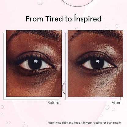 grace & stella Under Eye Brightener with Cooling Metal Rollerball - Ceramide & Caffeine Eye Cream for Puffy Eyes - Travel Size Toiletries - Vegan Skincare (15ml / 0.51floz)