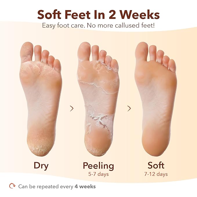 Purederm Exfoliating Foot Mask (3 Pack) – Regular Size Exfoliating Foot Masks for Cracked Feet, Dry Skin, Callused Feet…