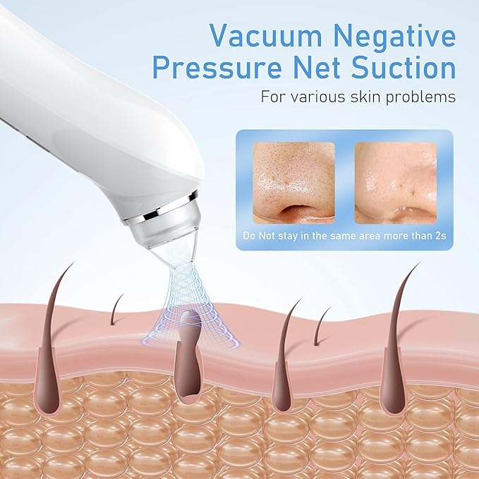 Facial Pore Blackhead Remover Vacuum, 1080P Camera Blackhead Remover, 20x Zoom, 8 LEDs ＆ 3 Suction Modes, 800mAh Battery & USB - 6 Heads Pore Cleaner Kit for Women&Men(Blue)