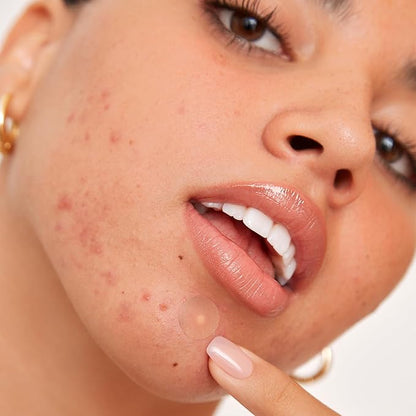 PEACE OUT Acne Healing Dots Helps Clear Blemishes Overnight, Fast Acting Hydrocolloid Pimple Patches for Breakouts with Salicylic Acid, Retinol and Aloe Vera, Award Winning Skincare Solution 60 Count