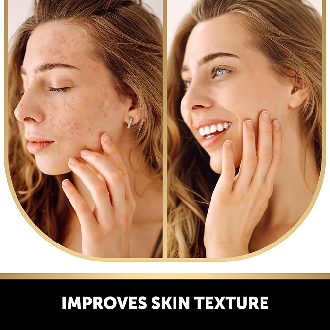 VALITIC Kojic Acid Vitamin C and Retinol Soap Bars with Turmeric for Dark Spot - Original Japanese Complex Infused with Collagen, Hyaluronic Acid, and Vitamin E (3 Pack)