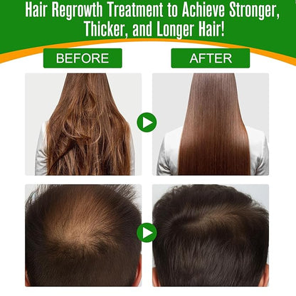 Batana Oil for Hair Growth,60ml 100% Pure Natural Cold Pressed Organic Oil,Promotes Hair Growth for Men & Women,Hydrating & Repairing Dry,Damaged Hair Skin Care,Enhances Hair & Skin Radiance