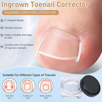 Ingrown Toenail Corrector Set with Correction Strips,Professional Ingrown Toenails Pedicure Tool Set, Toenail Correction Strips & Ingrown Toenail Corrector,Ingrown Nail Tool for Women Man