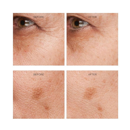 Erasa XEP 30 Rejuvenation Serum for Line Lifting and Crow's Feet