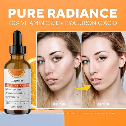 Professional Vitamin C Face Serum 20%, Anti Aging Facial Super Vit C Serum with Ascorbic Acid Hyaluronic Acid & Vitamin E for Dark Spots, Skin Care, Christmas Gift & Stocking | 1 Fl. Oz