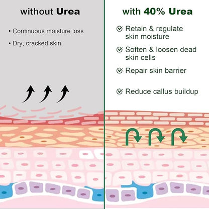 Urea Cream 40 Percent For Feet Maximum Strength, Plus 2% Salicylic Acid with Hyaluronic Acid, Urea Foot & Hand Cream for Dry Cracked, 4.6 oz