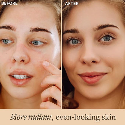 Vitamin C Face Serum - USA Made with Natural & Organic Ingredients, Skin Brightening Vitamin C Serum for Face for Women, Discoloration Correcting & Anti Aging Facial Formula with Antioxidants