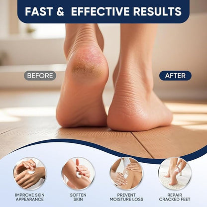 Urea Cream 60 Percent for Feet Maximum Strength, Urea Cream 60% Plus Salicylic Acid 2%, Foot & Hand Cream for Dry Cracked