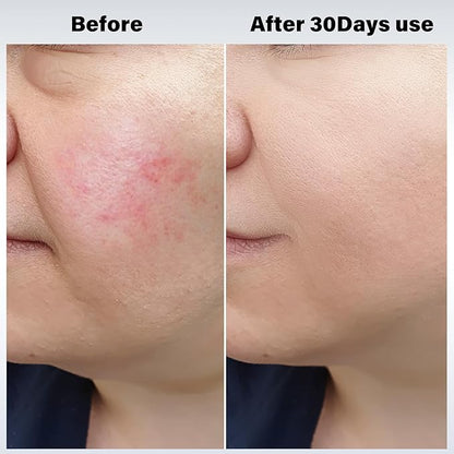 Cool and Hot Facial Firming Device, Light Face Tool with Vibration, Facial Massager with 8-21°C Cold, 38-47°C Hot, Electric Skin Care Kit