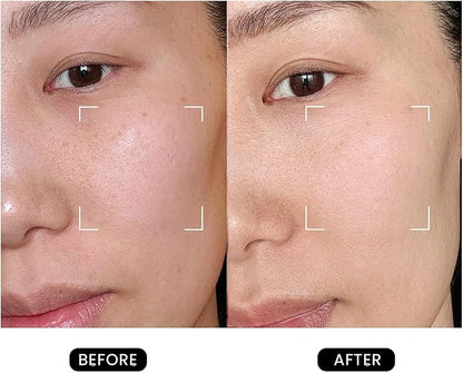 DermRays Revive Skincare for Anti-Aging, Glow Like Never Before,Multifunctional Beauty Device, Facial Massager for Home Use