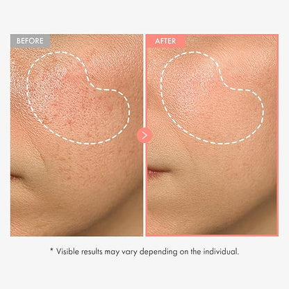 TOSOWOONG Peach 80 Niacin Serum, 5% Niacinamide, Alpha-Arbutin, Vitamin B12, Glass Skin, Hydrating Face Serum for Dark Spots, Pore Minimizer, Uneven Tone, Dullness, Korean Skincare, 33ml/1.11 fl. oz.