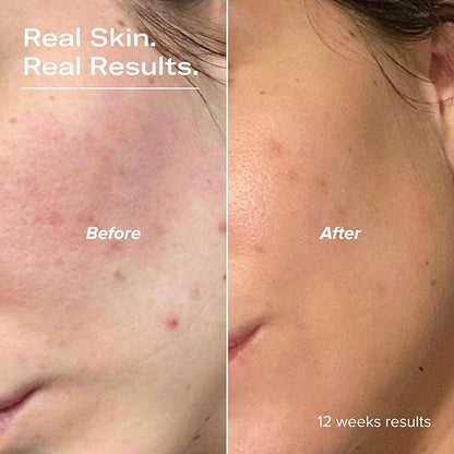 PLUMP Hyaluronic Acid Serum with 5D Hyaluronic Complex, Ectoin, Plant Ceramides, Vitamins B5 & E, Deep Hydration, Strengthens Skin Barrier, Fragrance-Free, 1 fl oz