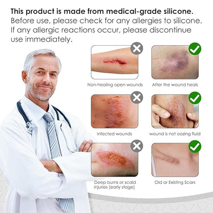 Silicone Scar Sheets,Silicone Scar Tape for Removal Treatment,Medical Grade Scar Tape for Surgical Scars,C-Section,Tummy Tuck,Scar Removal Away(1.6" x 60" Roll - 1.5M) Keloid Bump Removal