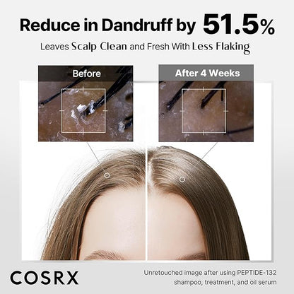 COSRX PEPTIDE 132 Hair Bonding Shampoo - Daily Scalp Treatment for Dandruff, Dry, Itchy or Flaky Scalp - Repairs & Strengthens Damaged Hair with Caffeine & Zinc PCA, For All Hair Types – 6.76 fl oz