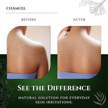 Chamuel Tea Tree Balm & Body Wash - The Best Product Combo to Soothe a Wide Variety of Skin Irritations