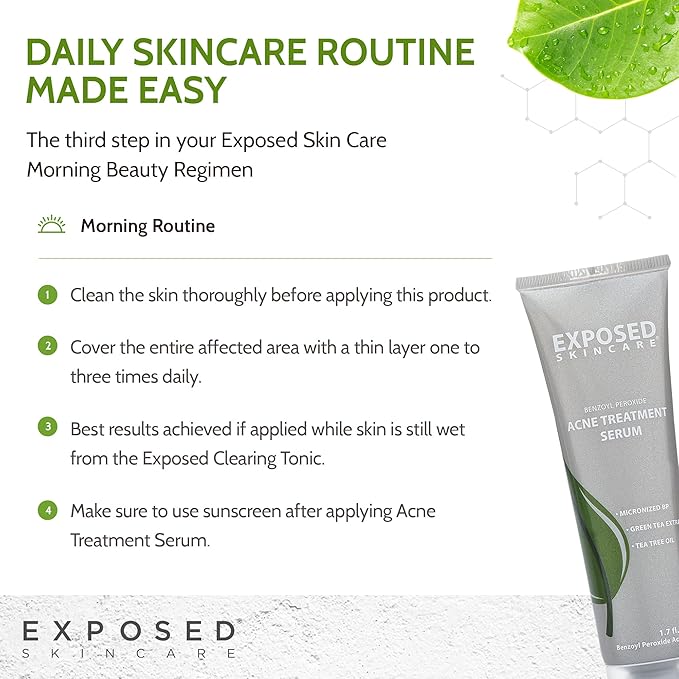 Exposed Skin Care, Acne Treatment Serum with 3.5% Benzoyl Peroxide – Lightweight Acne Spot Treatment – Quickly Clear Teen, Adult, Hormonal and Cystic Acne – Natural, Non-toxic and Cruelty Free