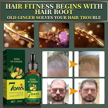 Biotin Hair Growth Serum for Hair Loss Treatment and Regrowth - Natural Ginger Essential Oil for Stronger, Thicker and Longer Hair for Women & Men (1.0 Fl Oz / 30ML)