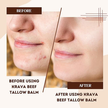 Beef Tallow for Skin, Beef Tallow for Face, Whipped Tallow Balm, Beef Tallow Moisturizer - Tallow Face Moisturizer, Tallow Cream | 100% Grass Fed, Lavender, 2 oz