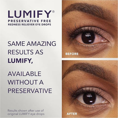 LUMIFY Preservative Free Eye Drops for Red Eyes, Redness Reliever for Sensitive Eye, Brighter and Whiter Looking Eyes, Works in 1 Minute & Lasts Up to 8 Hours, 20 Single-Use Vials