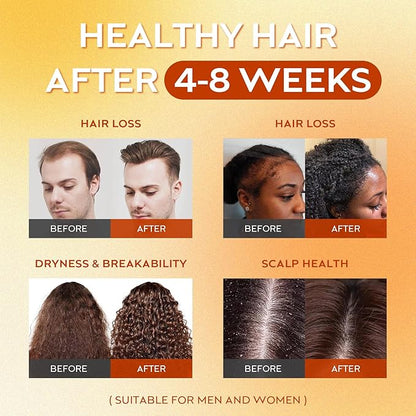 Raw Batana Oil for Hair Growth Dr Sebi, 100% Pure Organic Batana Hair Mask from Honduras, Wild Growth Hair Oil, Scalp Oil Promotes Hair Thickness, Prevents Loss for Men & Women, 2 fl oz (1 Pack)
