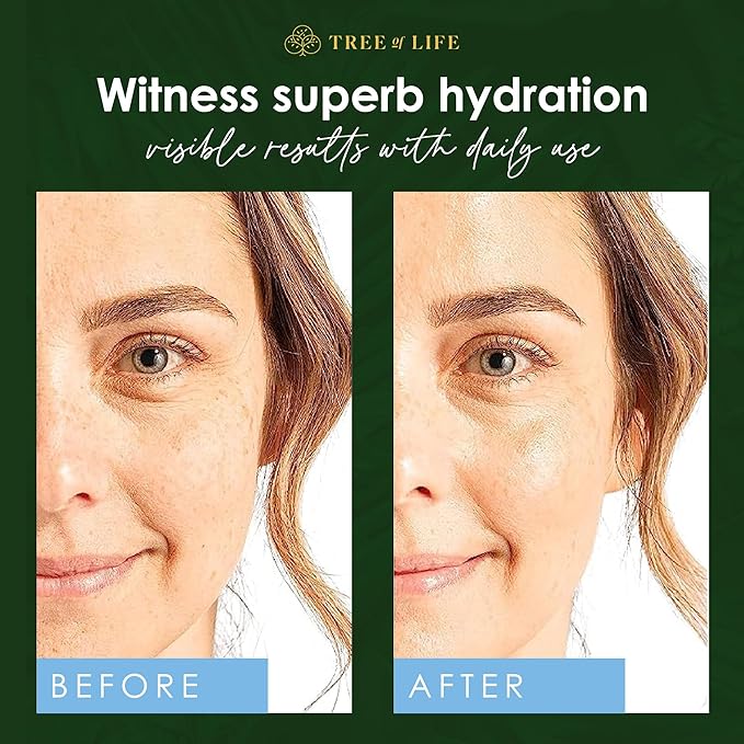Hyaluronic Acid Serum 1oz