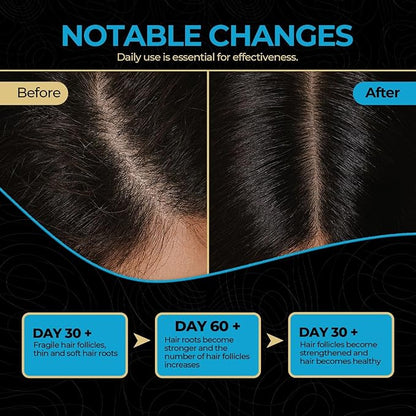 100% Pure Batana Oil – Raw, Organic & Unrefined Hair & Scalp Moisturizer | Natural Batana Hair Oil for Hair Growth | Rich in Vitamin E, Omega-6 & Phytosterols | Nourishes Dry & Damaged Hair – 4 oz